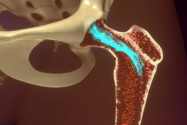 முதுகு, இடுப்பு, விலா எலும்புகள் அல்லது மண்டை ஓட்டில் தொடர்ச்சியான வலி!