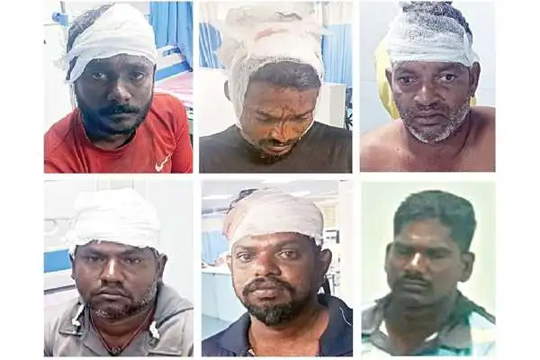 கடற்கொள்ளையர்கள் தாக்குதல் – 20 மீனவர்கள் காயம்!